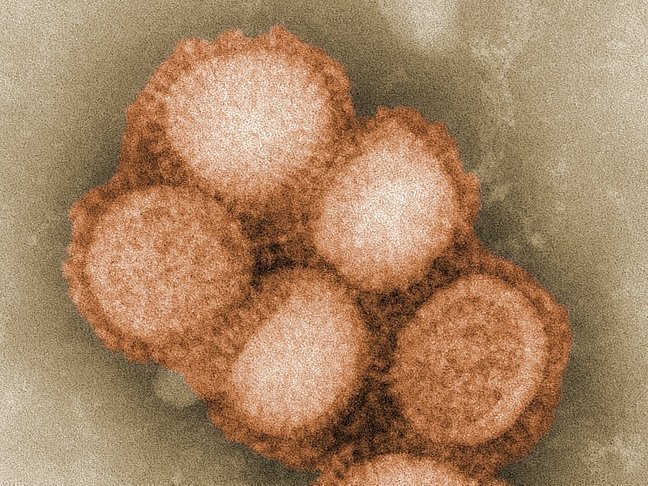 Создана первая вакцина против всех вирусов гриппа